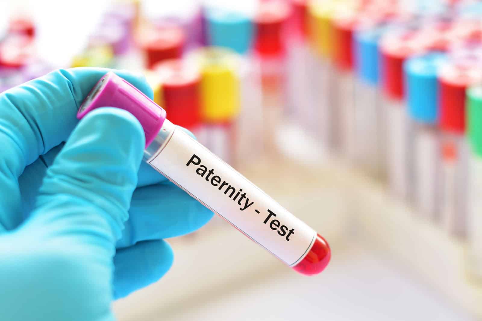 You are currently viewing How Do You Test For Paternity?
